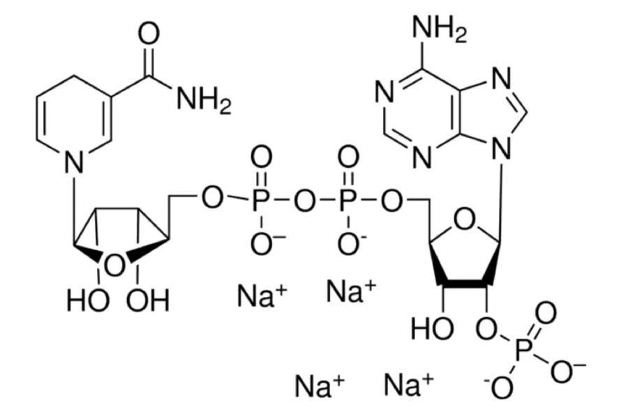������� �����: ��� NAD ������ �� �������� � ��� � ���� ������