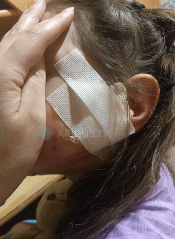 Собака покусала 7-летнего ребенка в центре Улан-Удэ