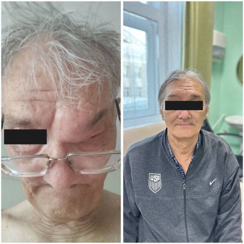 В Улан-Удэ врачи спасли пациента от смертельной угрозы