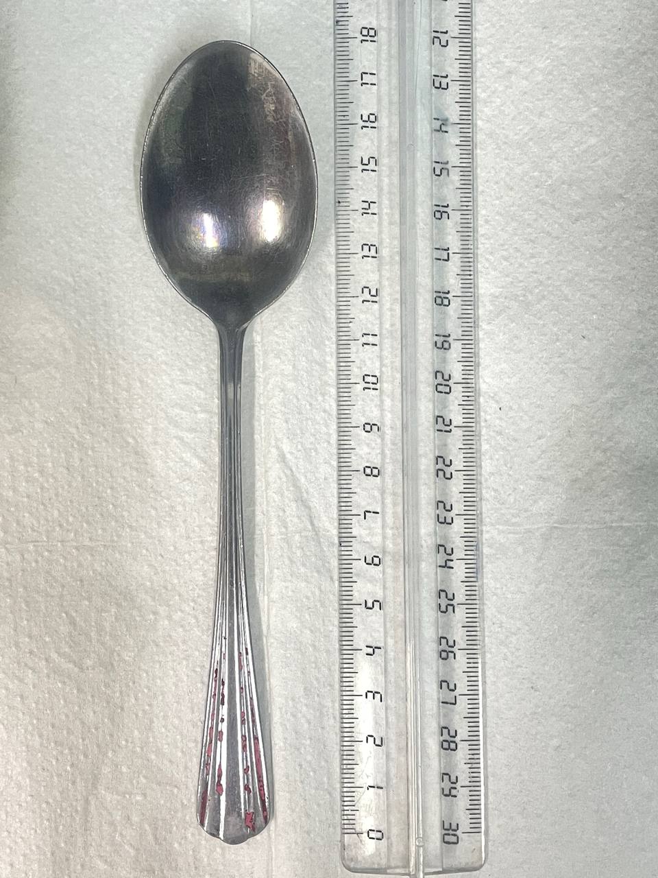 Врачи БСМП в Улан-Удэ извлекли из желудка пациентки столовую ложку