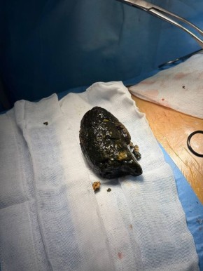 ������ ����-��� ����� �� ������������ ���� ����� �������� ������