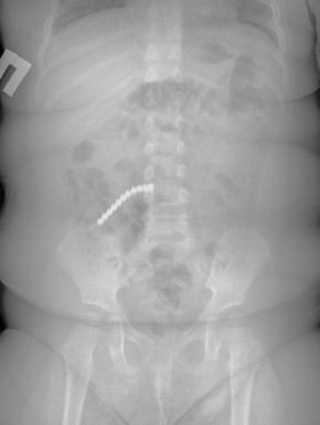 ���������� ������ �� ������� ��������� 20 ��������