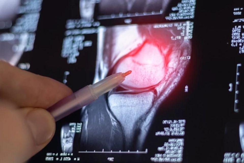 ��� ������� ������ �� �������: ��� ������� ���� ��� ����������� � ��������